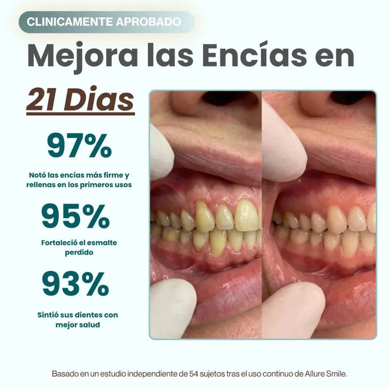 CollaGum AlureSmile — Frena la retracción de encías desde casa